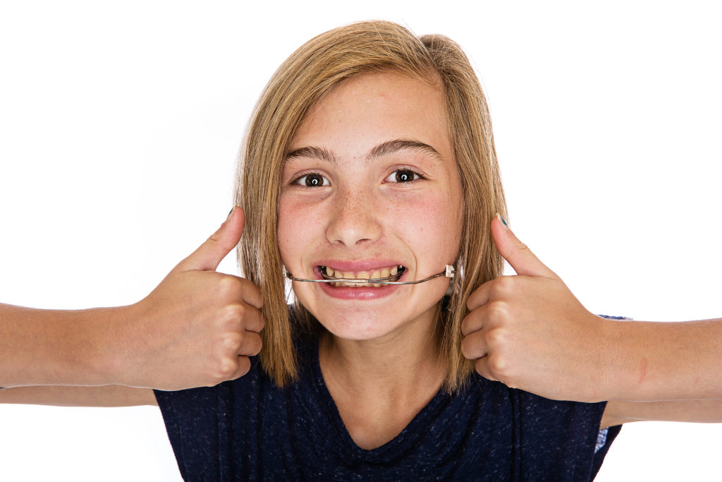 girl with a retainer smiling