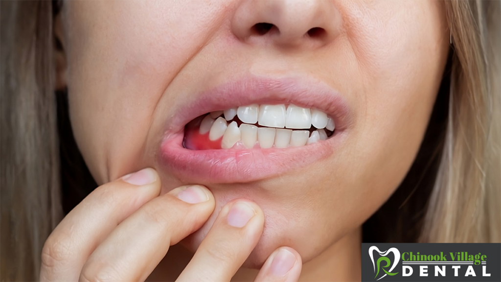 A woman showing her red gums.